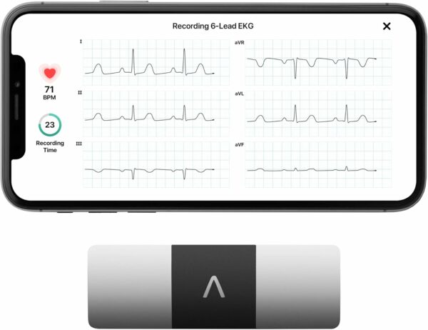 KardiaMobile 6-Lead Personal EKG Monitor – Six Views of The Heart – Detects AFib and Irregular Arrhythmias – Instant Results in 30 Seconds – Works with Most Smartphones - FSA/HSA Eligible - For Sale - Price